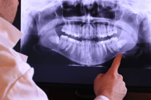 Best After-Hours Dental Care in Bazon, CA